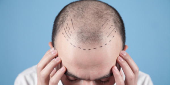 Why some hair treatments work while others fall flat